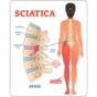 Non-Surgical Solutions for Sciatica Relief