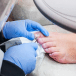 ingrown toenail removal near me